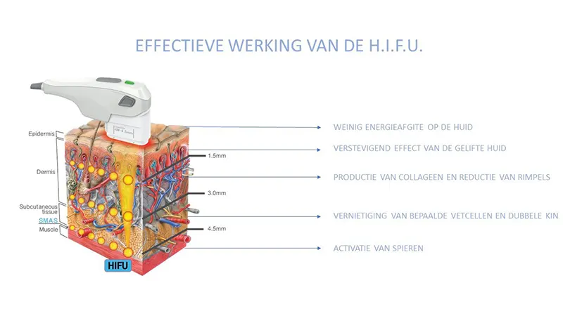 Effectieve werking van de H.I.F.U